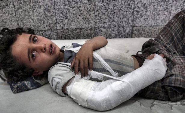 CNN, Yemen’deki Suudi Zulmü…